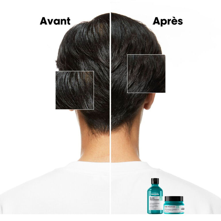Avant/apr&egrave;s utilisation de la gamme Scalp Advanced